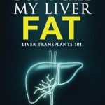 Discover Life-Saving Insights in ‘Don’t Call My Liver Fat: Liver Transplants 101’ – A Must-Read Guide for Patients and Caregivers! Discover Life-Saving Insights in ‘Don’t Call My Liver Fat: Liver Transplants 101’ – A Must-Read Guide for Patients and Caregivers!