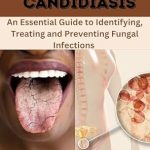 Discover the Secrets to Overcoming Fungal Infections: A Review of REVERSING CANDIDIASIS – An Essential Guide to Identifying, Treating and Preventing Fungal Infections Discover the Secrets to Overcoming Fungal Infections: A Review of REVERSING CANDIDIASIS – An Essential Guide to Identifying, Treating and Preventing Fungal Infections
