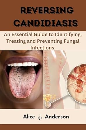 Discover the Secrets to Overcoming Fungal Infections: A Review of REVERSING CANDIDIASIS – An Essential Guide to Identifying, Treating and Preventing Fungal Infections