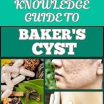 Unlock the Secrets to Knee Health: A Comprehensive Review of ‘KNOWLEDGE GUIDE TO BAKER’S CYST: Essential Manual To Symptoms, Diagnosis, Treatment Options, And Prevention For Optimal Knee Health’