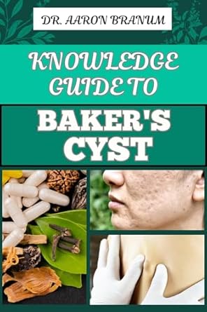 Unlock the Secrets to Knee Health: A Comprehensive Review of ‘KNOWLEDGE GUIDE TO BAKER’S CYST: Essential Manual To Symptoms, Diagnosis, Treatment Options, And Prevention For Optimal Knee Health’