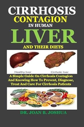 Essential Insights and Strategies: CIRRHOSIS CONTAGION IN HUMAN LIVER AND THEIR DIETS – A Simple Guide On Cirrhosis Contagion And Knowing How To Prevent, Diagnose, Treat And Care For Cirrhosis Patients
