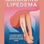 Transform Your Life with ‘Managing Lipe edema: A Complete Guide to Treatment, Self-Care, and Improved Quality of Life’ – A Must-Read Review!
