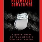 Unveiling the Secrets: A Comprehensive Review of Pacemakers Demystified: A Quick Guide to Your Heart’s New Best Friend