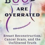 Transformative and Eye-Opening: A Review of ‘Boobs Are Overrated: Breast Reconstruction, Cancer Scars, and the Unfiltered Truth’
