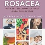 Discover the Secrets to Radiant Skin: Healing Rosacea With Anti-inflammatory Diet And Healthy Lifestyle: My Proven Methods For Healthy Skin Without Using Medication