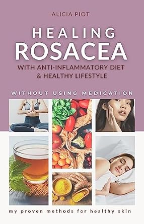 Discover the Secrets to Radiant Skin: Healing Rosacea With Anti-inflammatory Diet And Healthy Lifestyle: My Proven Methods For Healthy Skin Without Using Medication