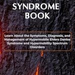Essential Guide: Ehlers Danlos Syndrome Book – Learn About the Symptoms, Diagnosis, and Management of Hypermobile Ehlers Danlos Syndrome and Hypermobility Spectrum Disorders