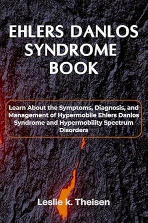 Essential Guide: Ehlers Danlos Syndrome Book – Learn About the Symptoms, Diagnosis, and Management of Hypermobile Ehlers Danlos Syndrome and Hypermobility Spectrum Disorders