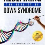 Transformative Insights Await: A Review of Redefining the Reality of Down Syndrome: The Power of an Integrative Mindset